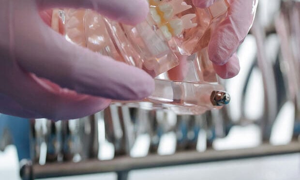 person handling dentures